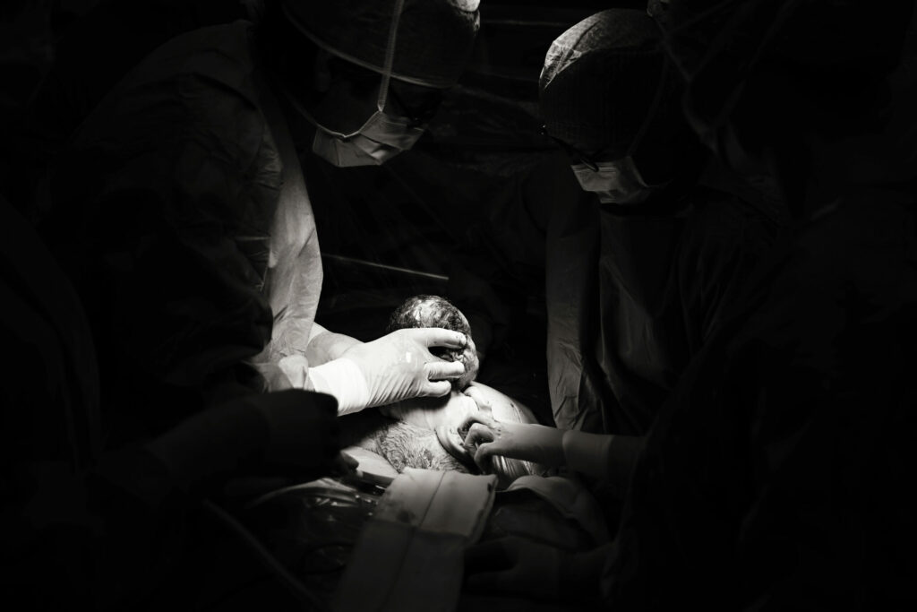 Zwart-witfoto van artsen met de pasgeboren baby, geboortefotografie